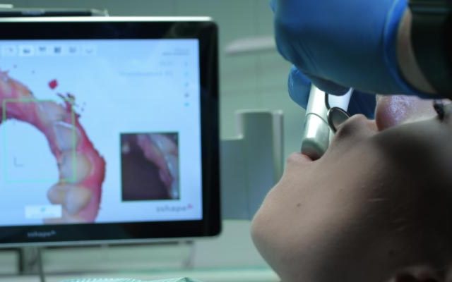 Empreintes dentaire numériques Radiologie numérique, Scanner dentaire, Tomographie dentaire, Imagerie dentaire, Scanner 3D dentaire, Diagnostic dentaire