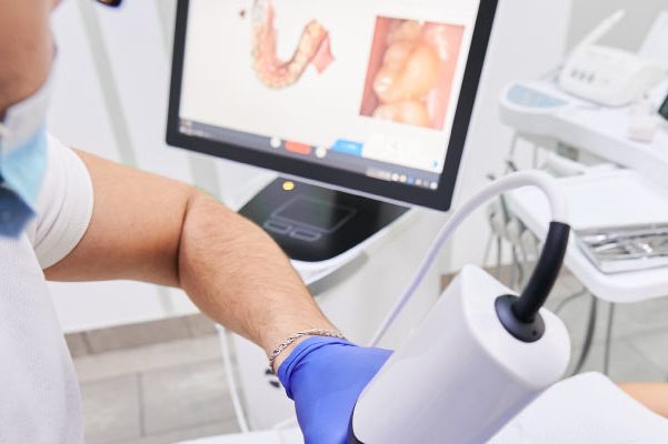 Scanner dentaire, Tomographie dentaire, Imagerie dentaire, Radiographie dentaire, Scanner 3D dentaire, Diagnostic dentaire